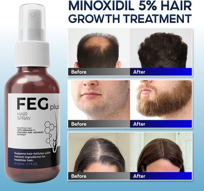 FEG PLUS Minoxidil Hair & Beard Growth Serum: