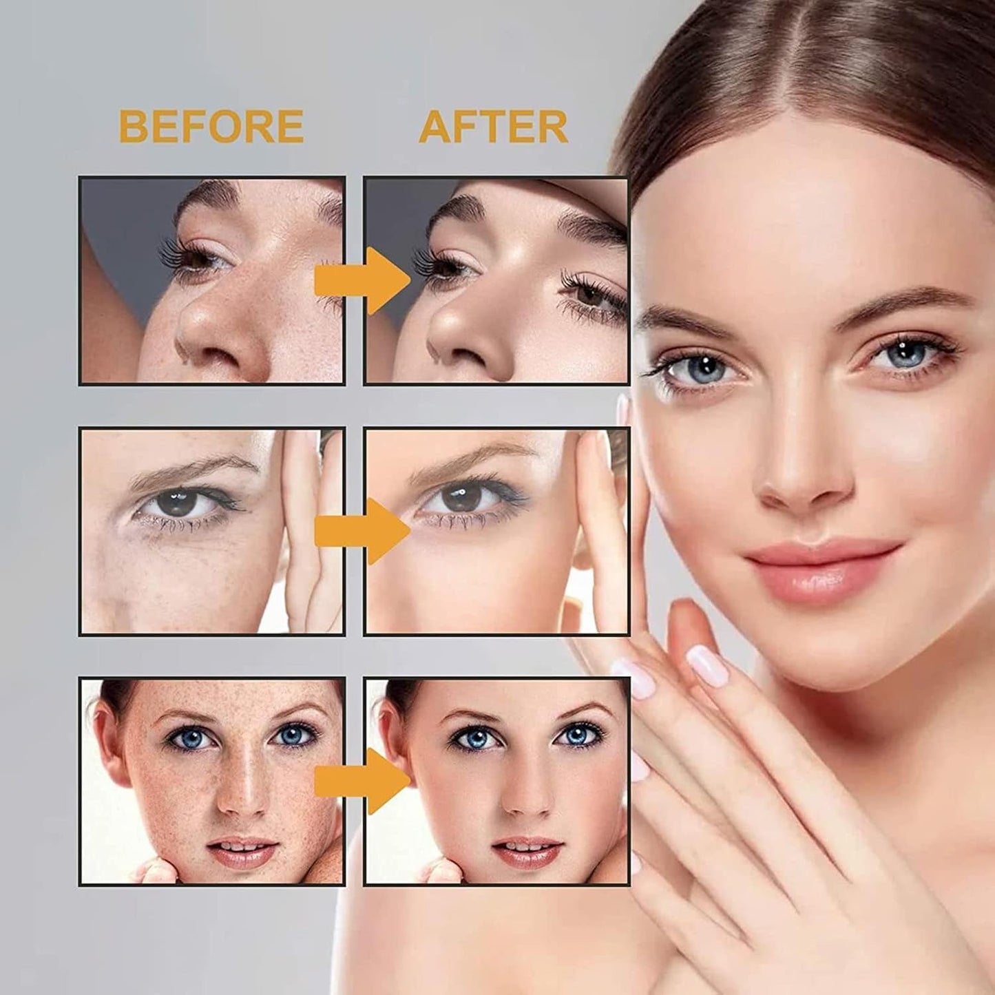 Japenese Melasma Cream: