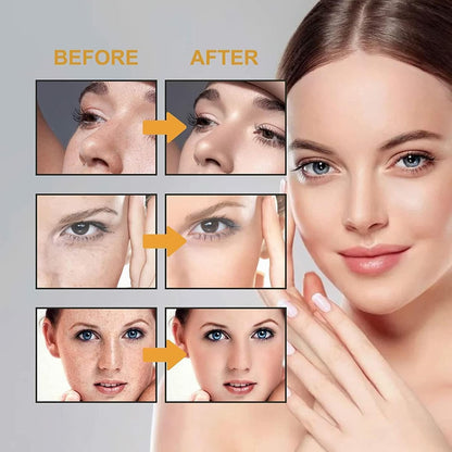 Japenese Melasma Cream: