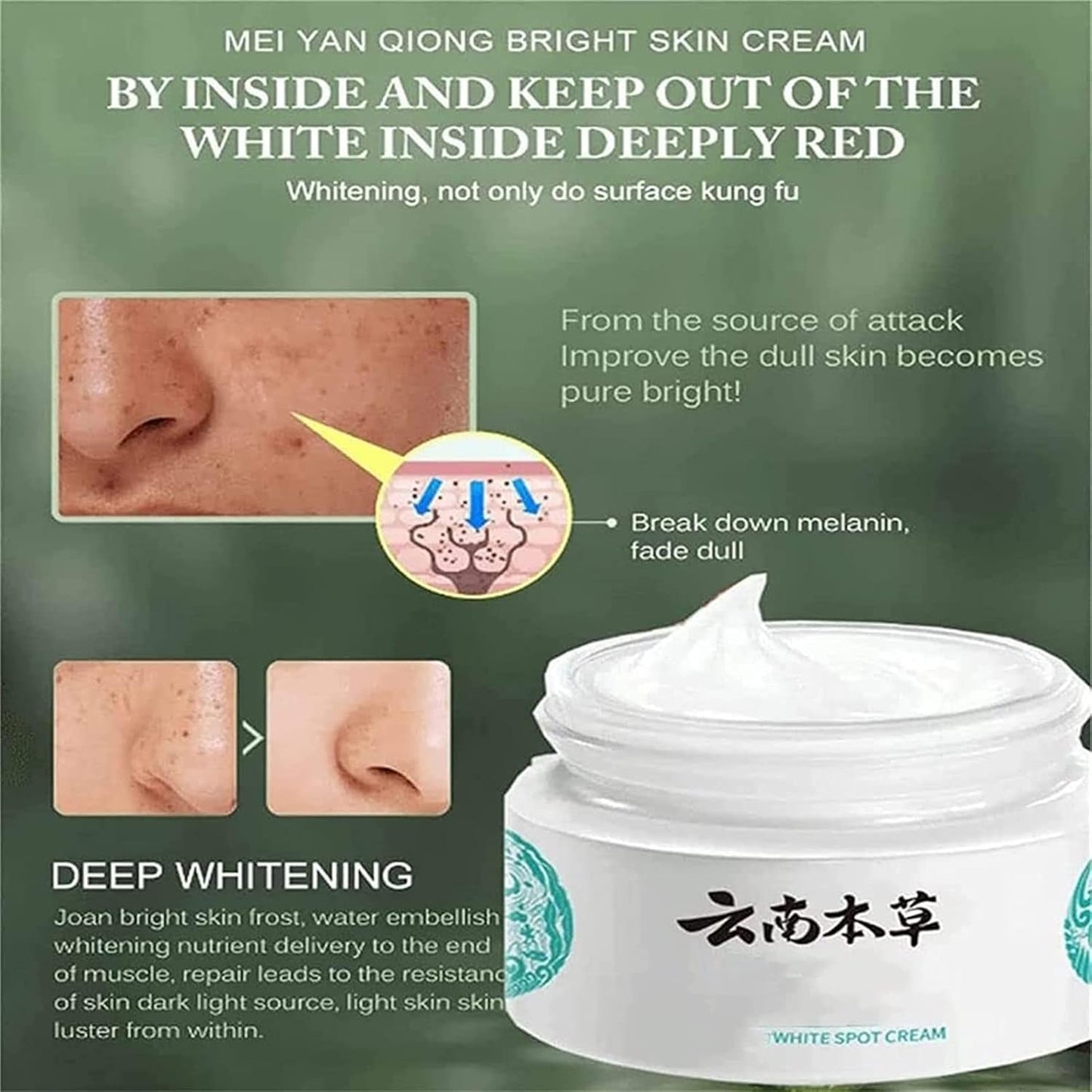 Japenese Melasma Cream: