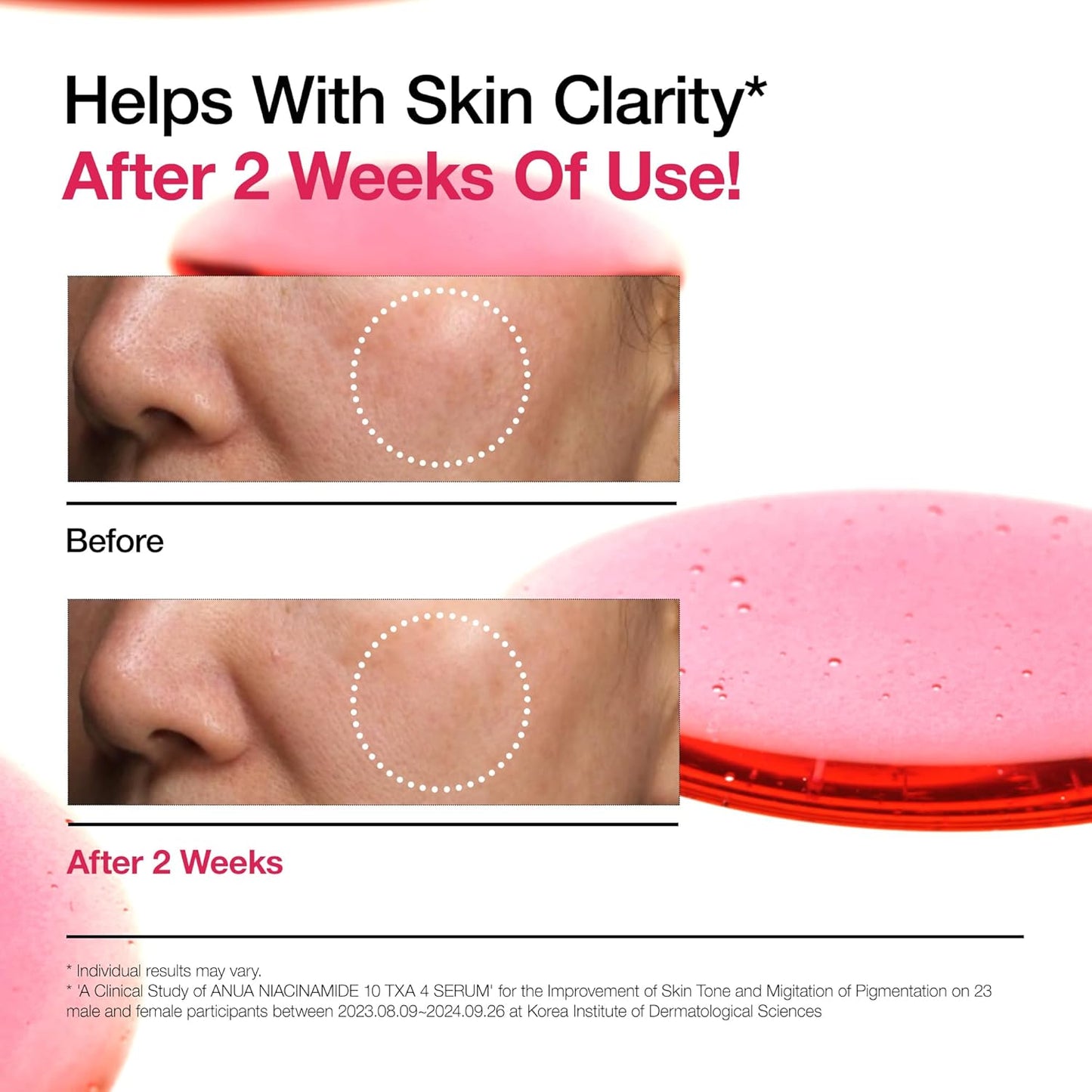 ANUA Niacinamide 10 + TXA 4 Serum:
