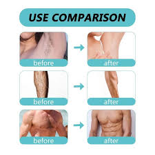Hair Removal Spray (Remove Hair In 3 Minutes)